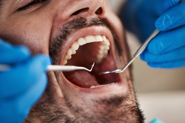Best Pediatric Emergency Dentist in Pompano Beach, FL